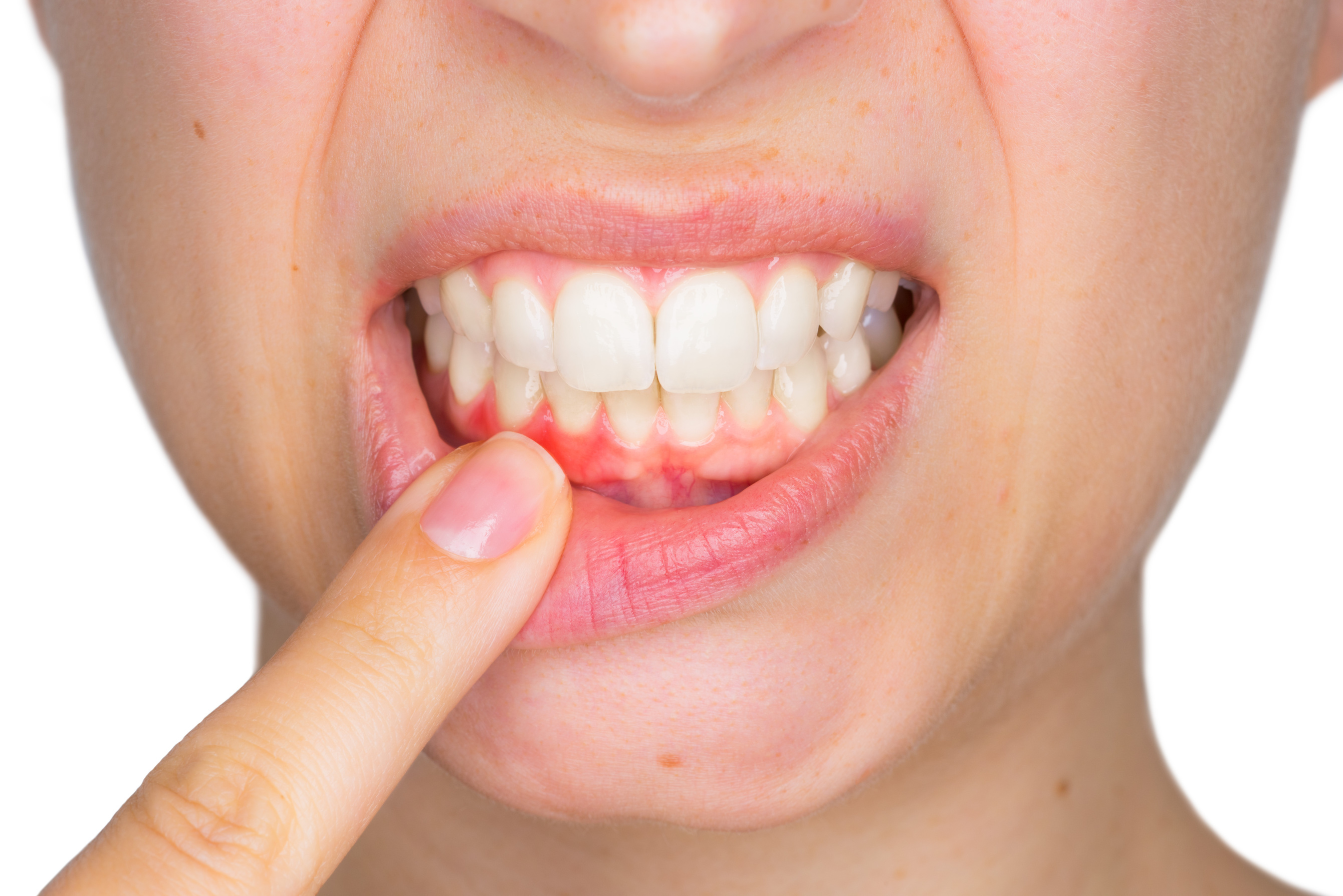 نصائح مفيدة لمتاعب الأسنان واللثة